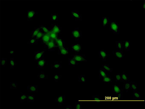 KLF11 Antibody in Immunocytochemistry (ICC/IF)