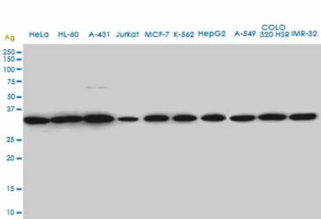 SUPT3H Antibody in Western Blot (WB)