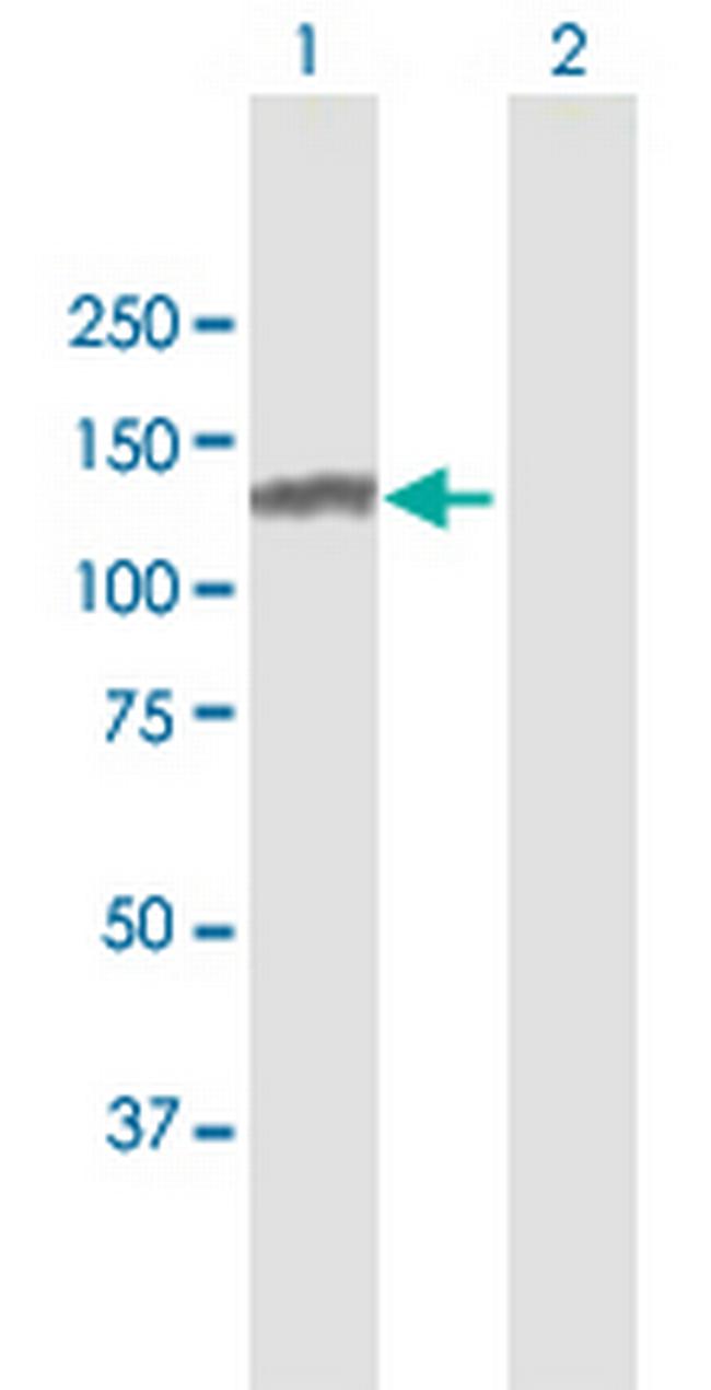 SMARCA5 Antibody in Western Blot (WB)