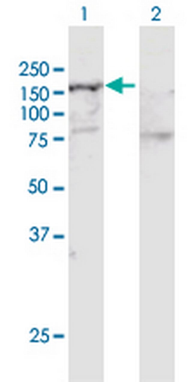 SMARCA5 Antibody in Western Blot (WB)