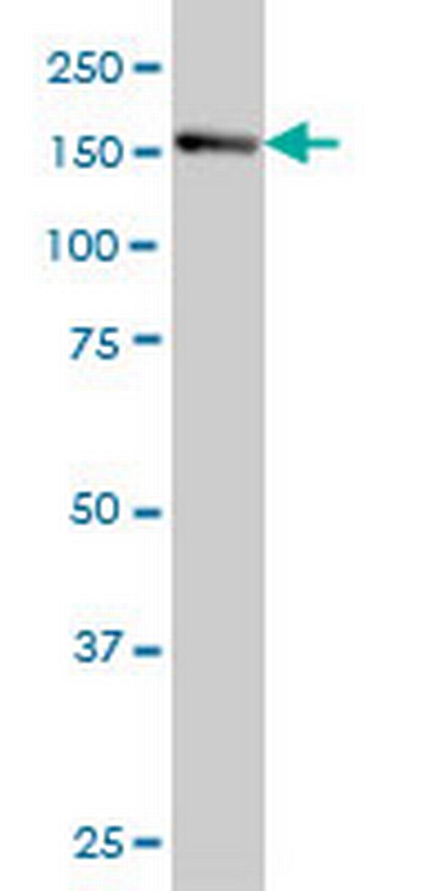 IRS4 Antibody in Western Blot (WB)