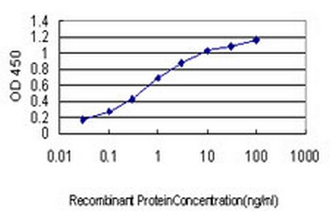 CDC42BPA Antibody in ELISA (ELISA)