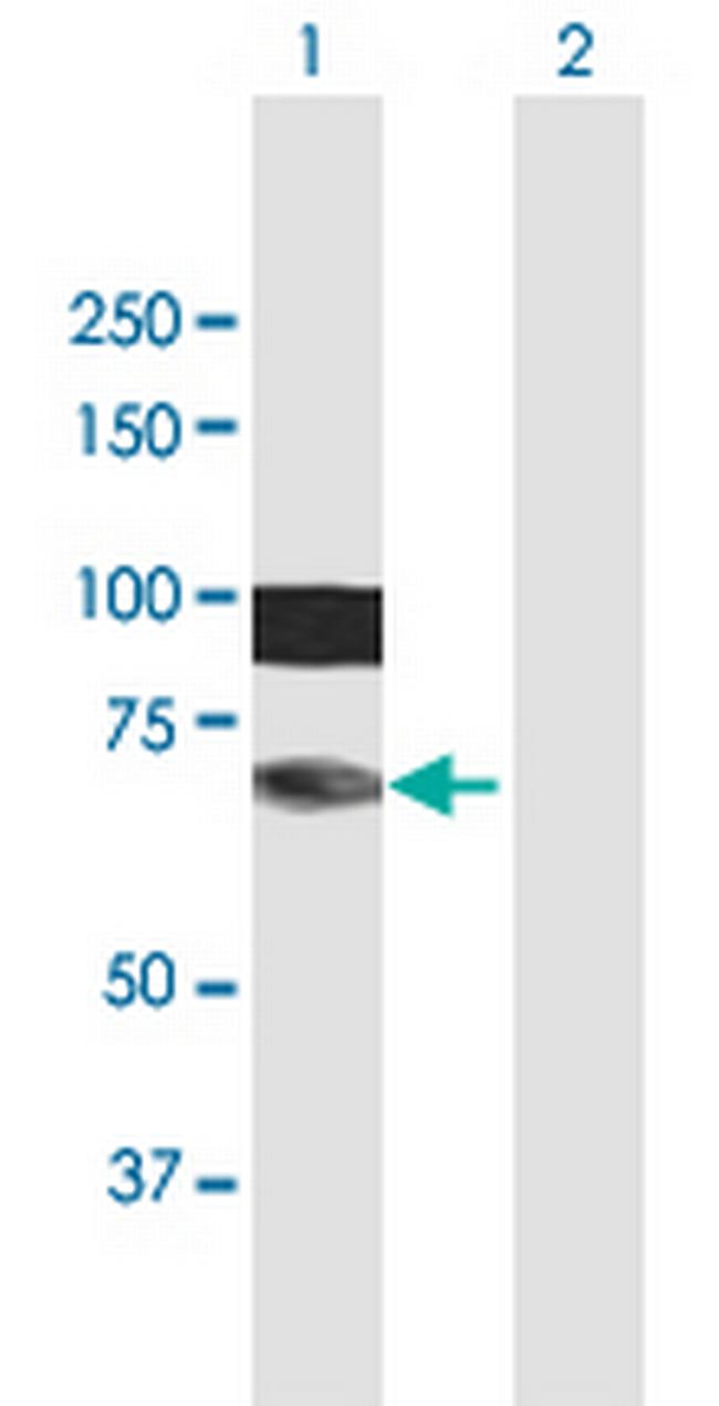 HIRIP3 Antibody in Western Blot (WB)