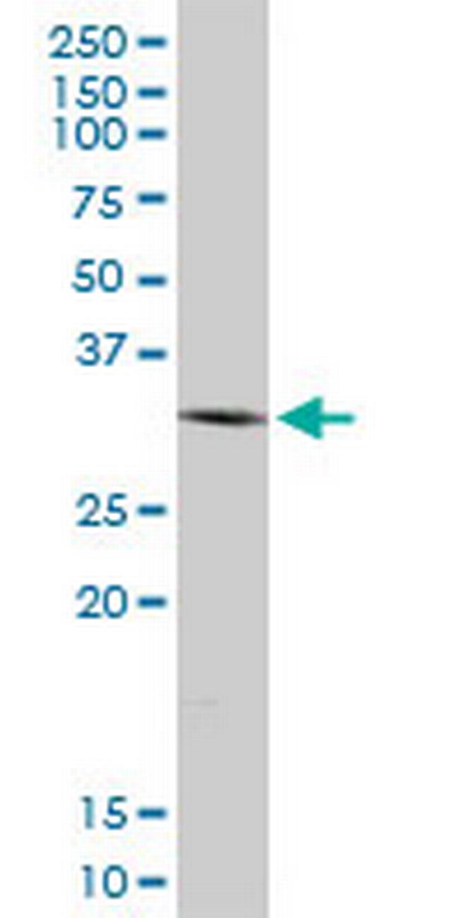 SIP1 Antibody in Western Blot (WB)