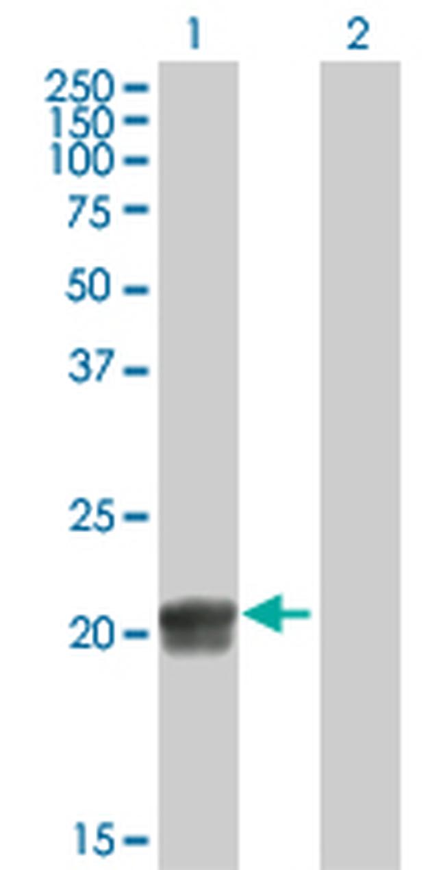 RGS5 Antibody in Western Blot (WB)
