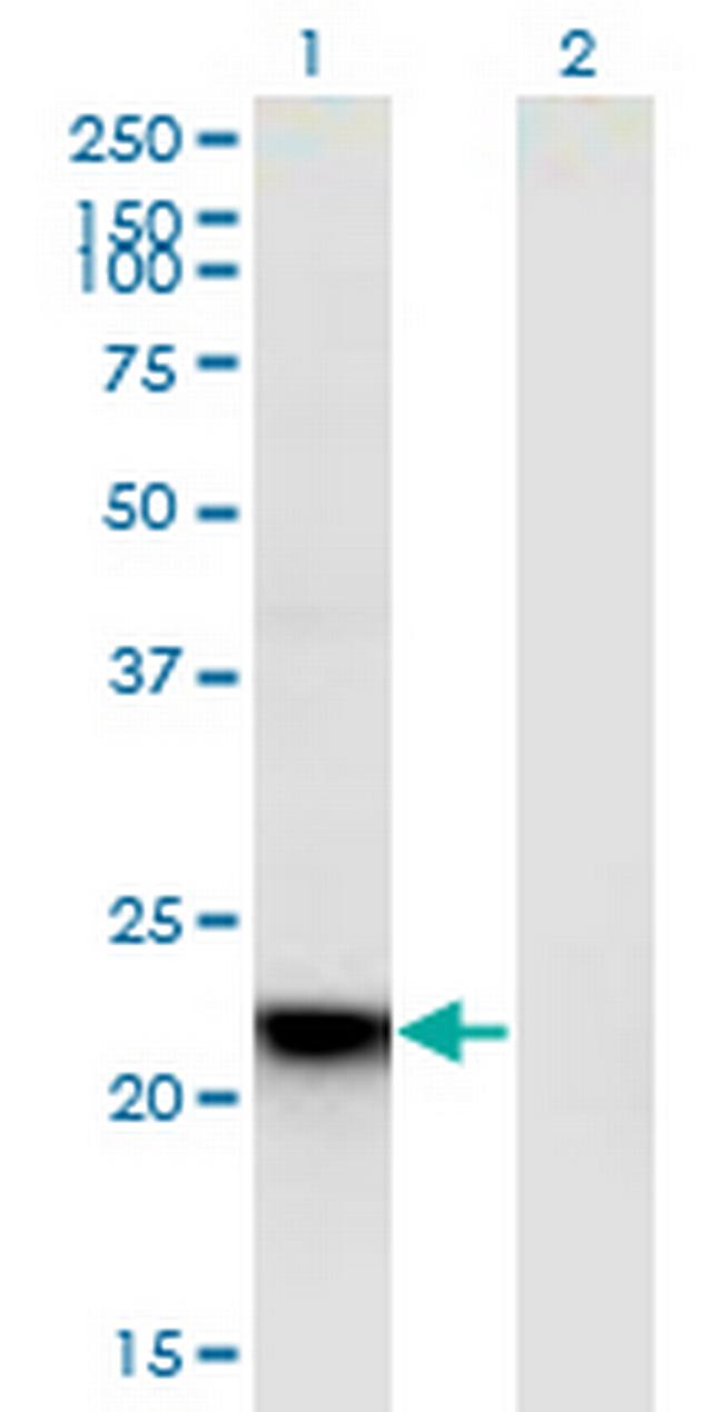 RGS5 Antibody in Western Blot (WB)
