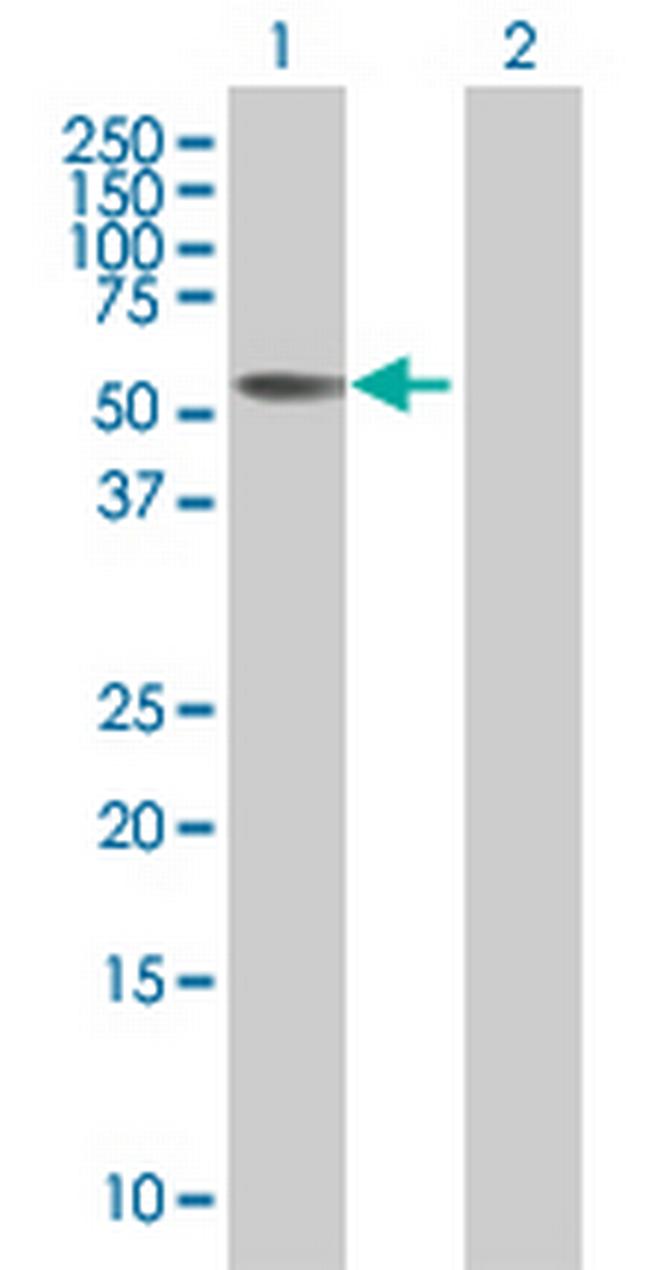 PRSS12 Antibody in Western Blot (WB)