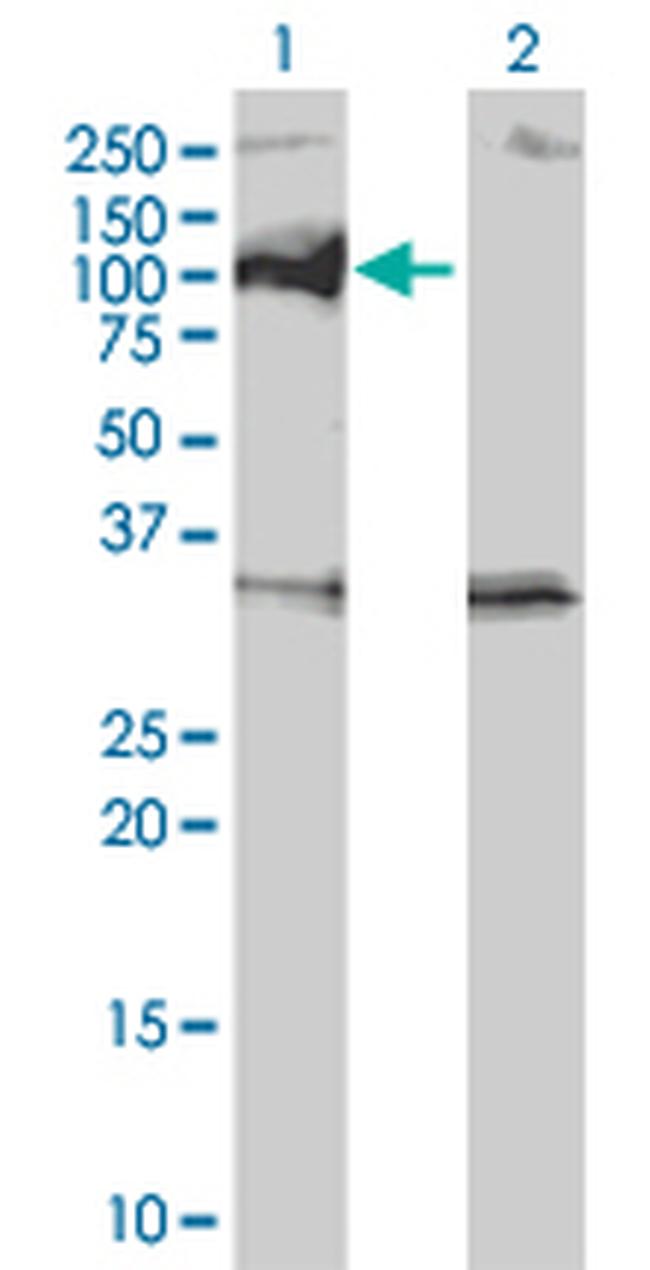PPM1D Antibody in Western Blot (WB)