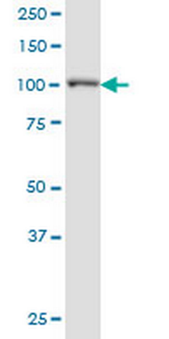 PPFIBP2 Antibody in Western Blot (WB)
