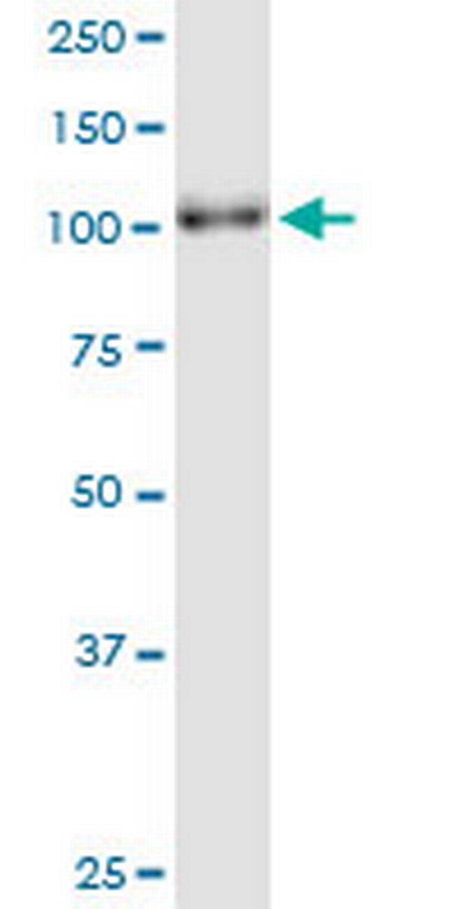 PARG Antibody in Western Blot (WB)