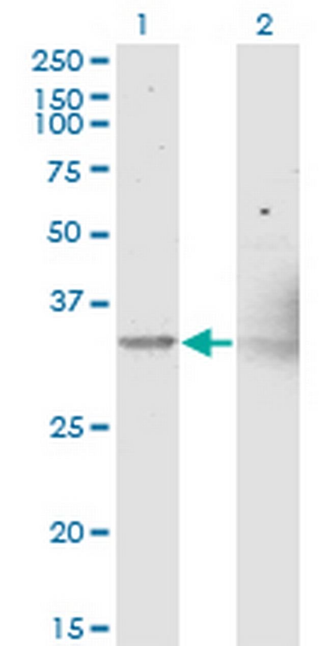 NIPSNAP1 Antibody in Western Blot (WB)