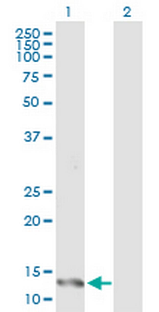 IFITM1 Antibody in Western Blot (WB)