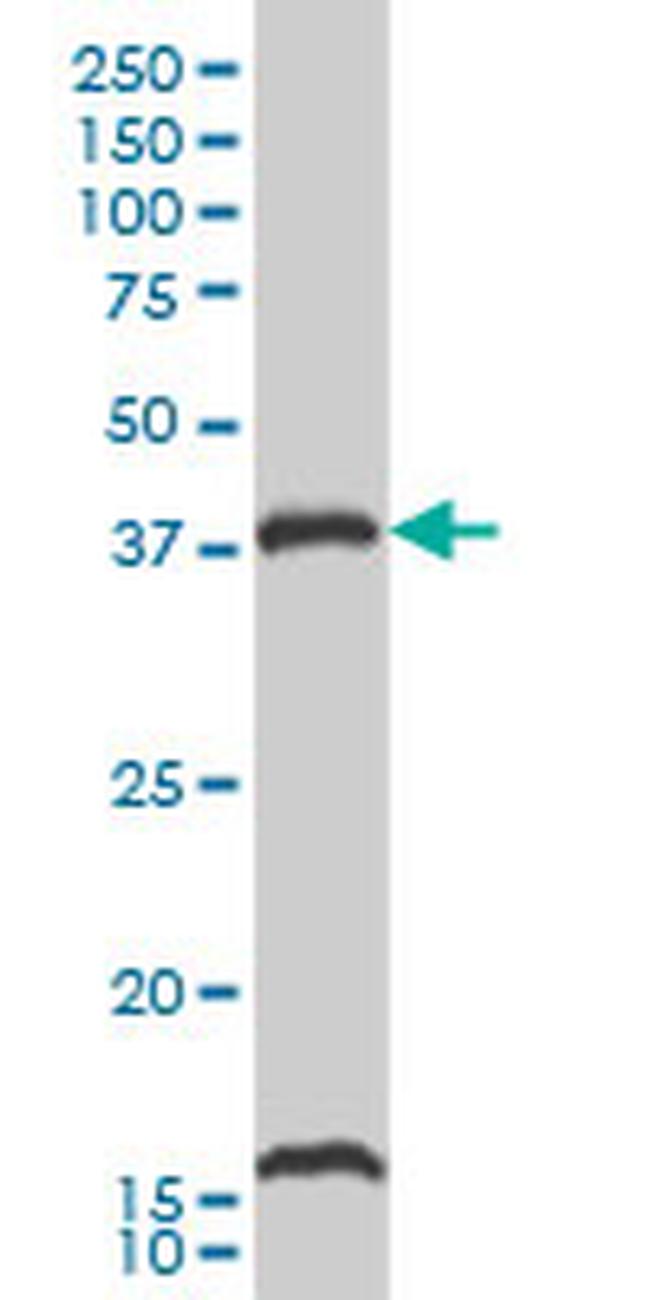 CAMK1 Antibody in Western Blot (WB)