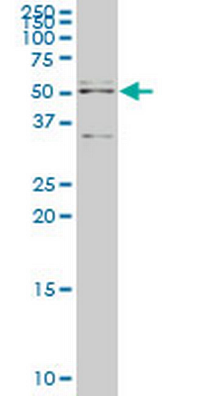 API5 Antibody in Western Blot (WB)