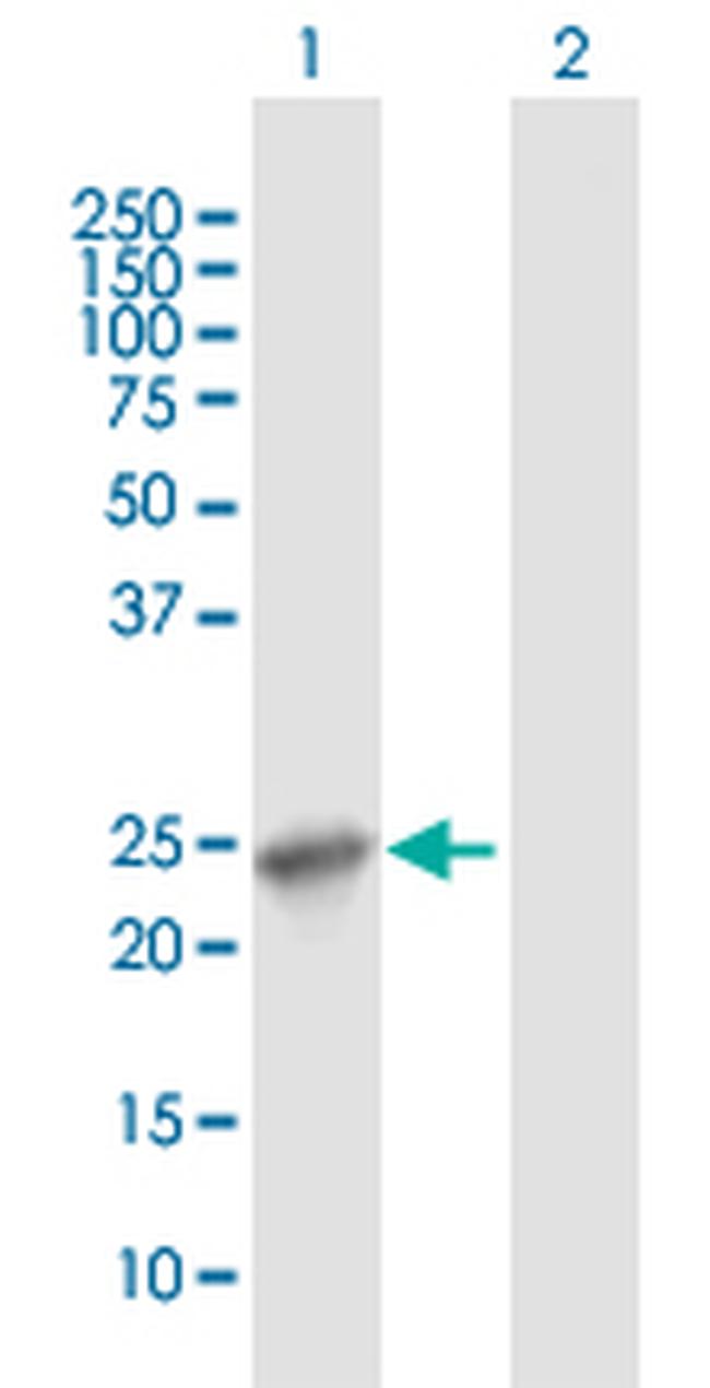 APOL1 Antibody in Western Blot (WB)