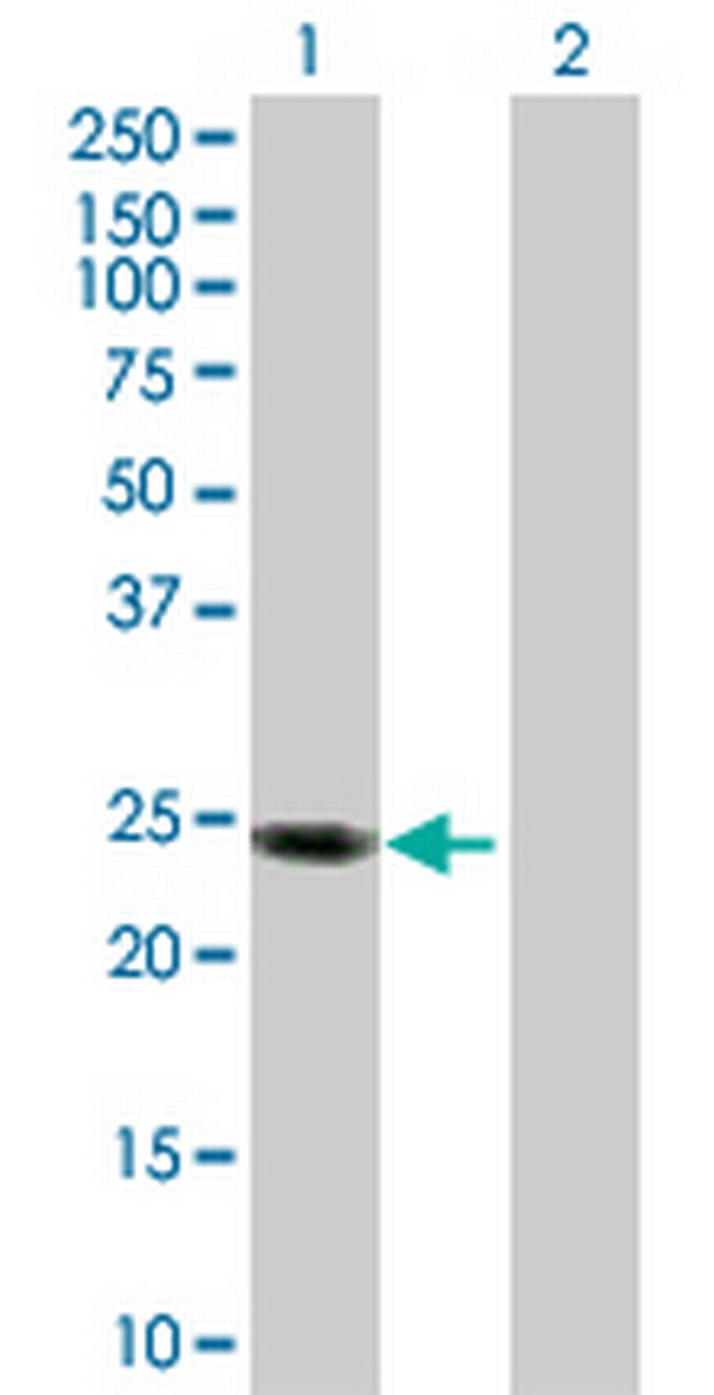 APOL1 Antibody in Western Blot (WB)