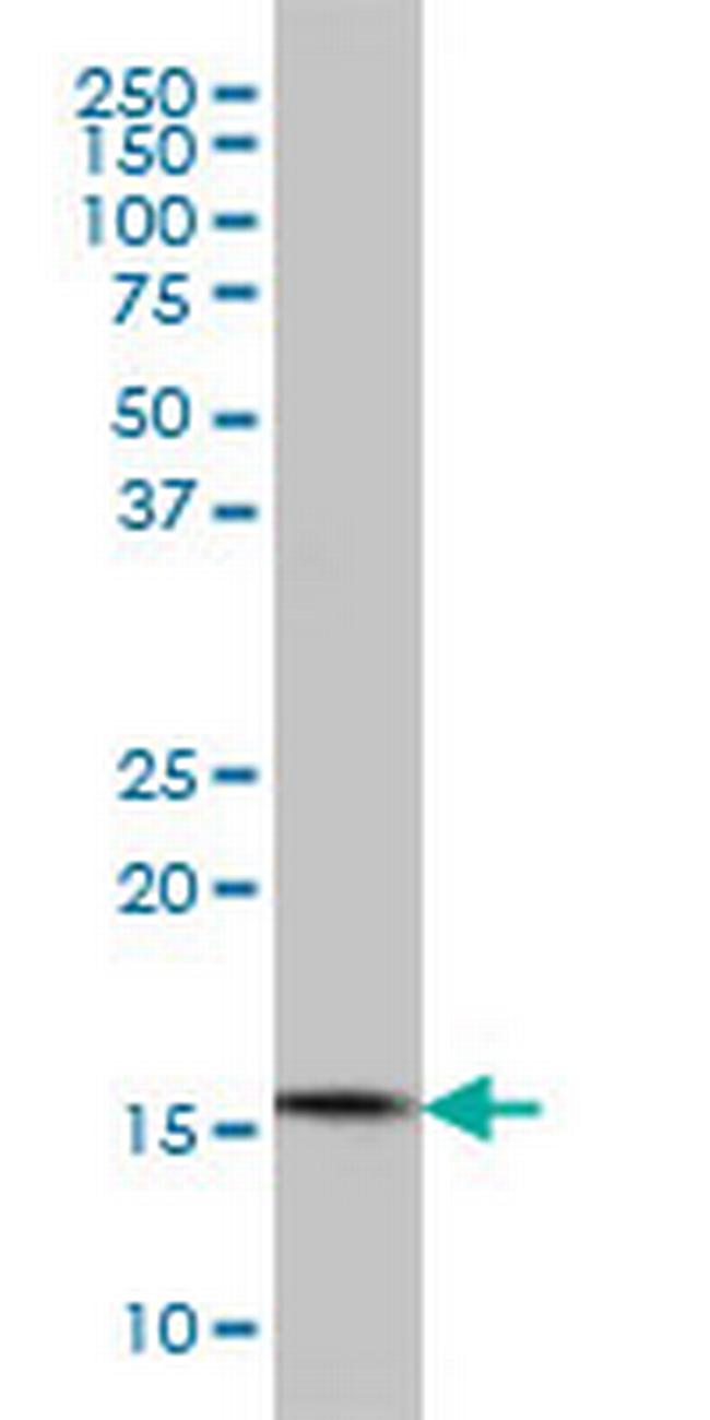CGGBP1 Antibody in Western Blot (WB)