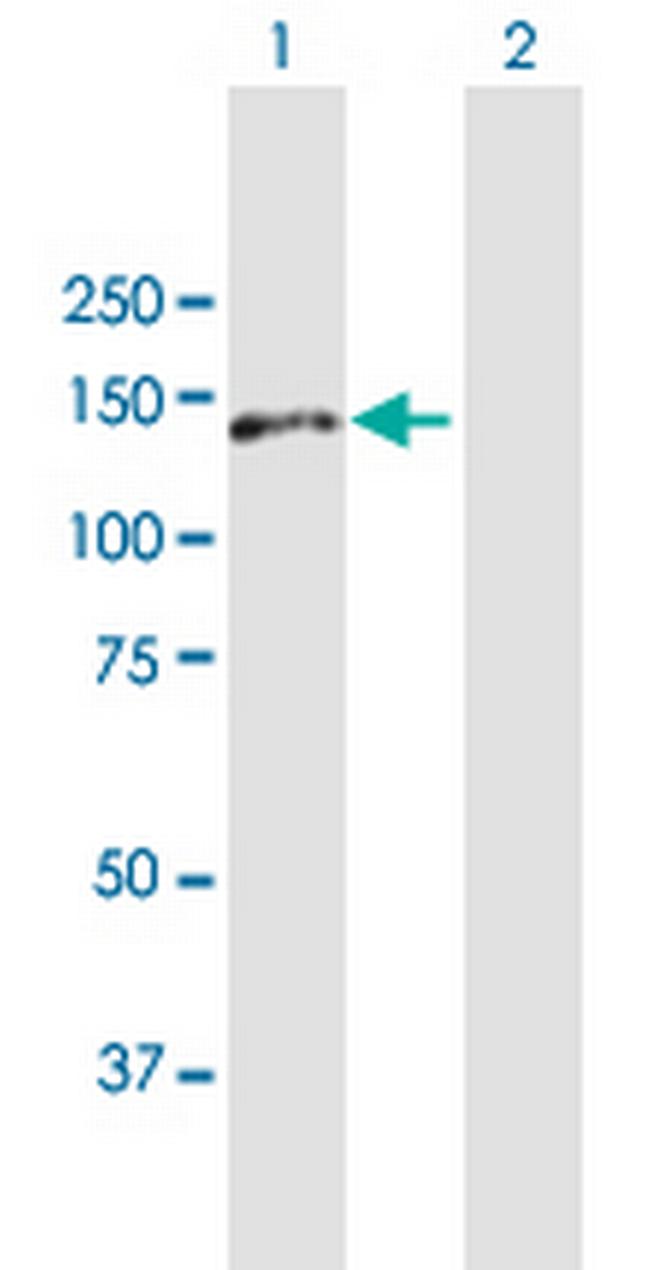 AP3B1 Antibody in Western Blot (WB)