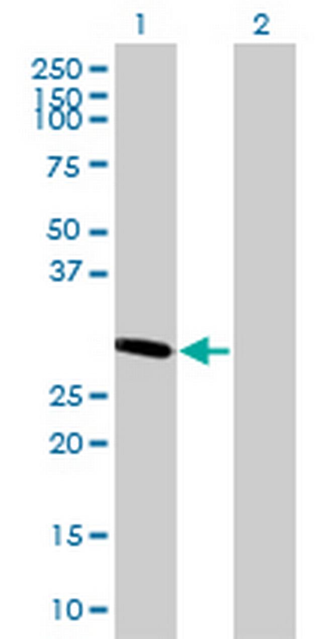 FCN3 Antibody in Western Blot (WB)