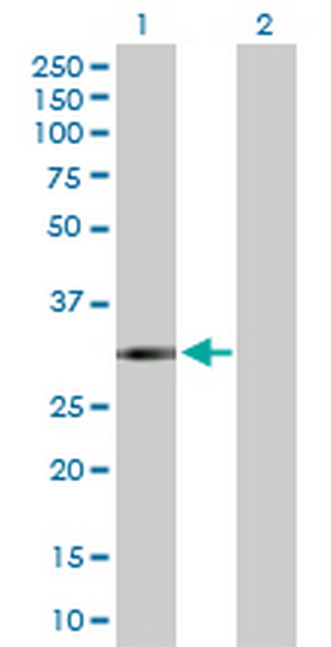 FCN3 Antibody in Western Blot (WB)