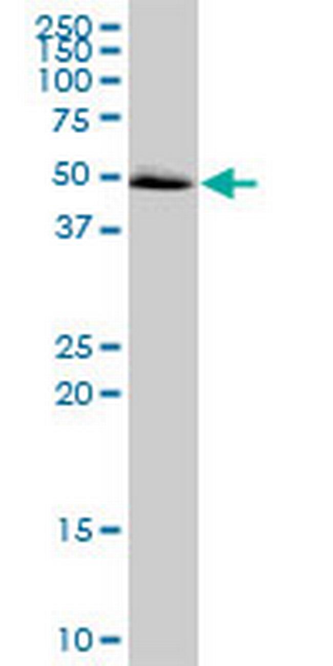 MAPKAPK5 Antibody in Western Blot (WB)