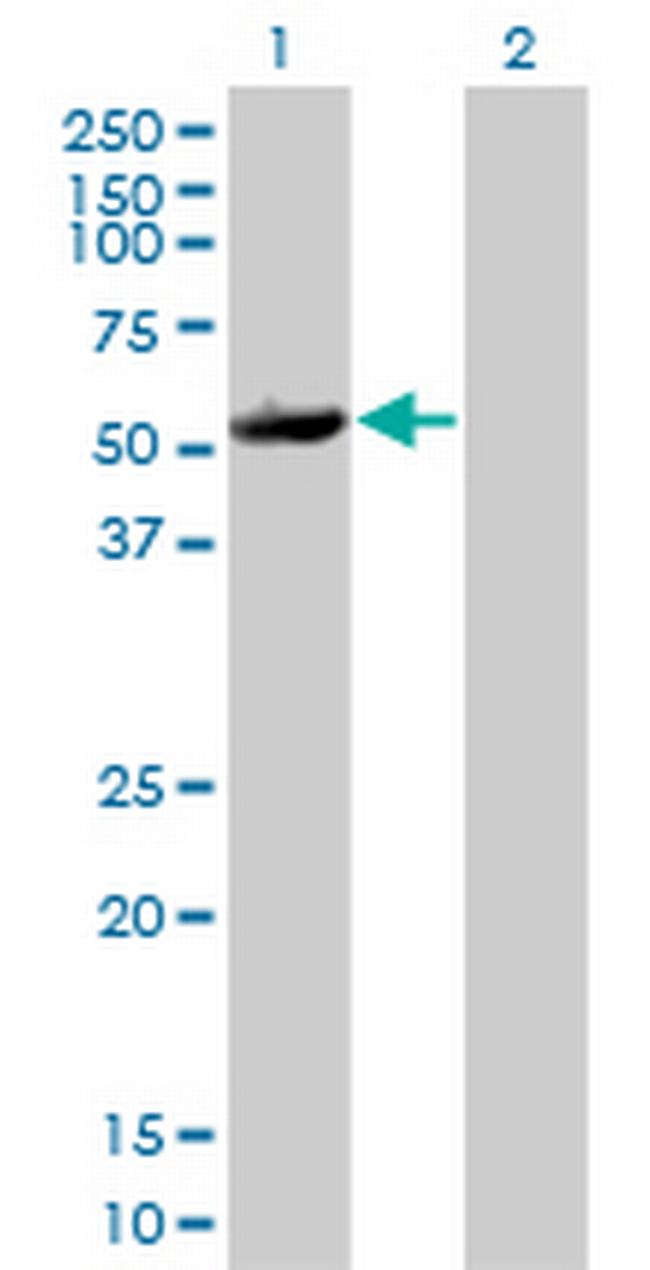 MAPKAPK5 Antibody in Western Blot (WB)