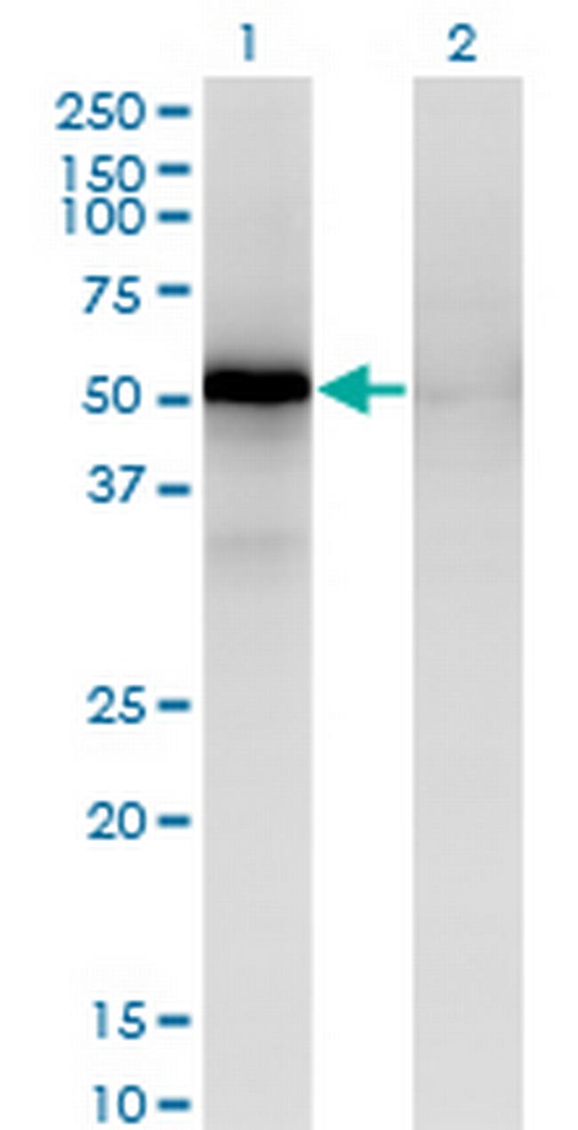 MAPKAPK5 Antibody in Western Blot (WB)
