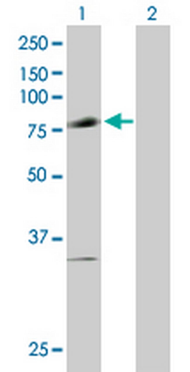 PIAS1 Antibody in Western Blot (WB)