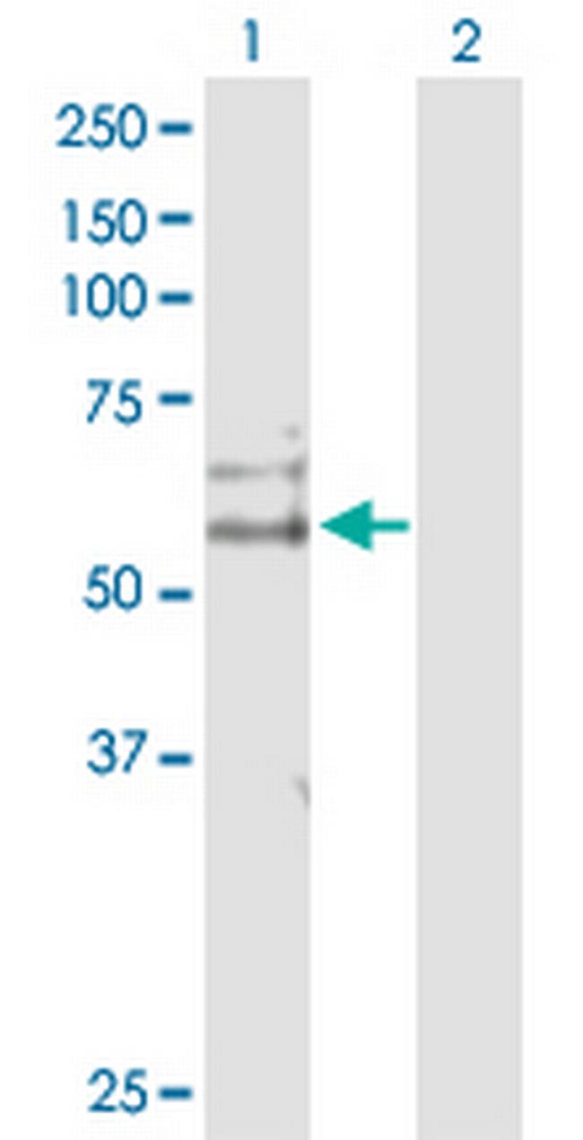 CDC14B Antibody in Western Blot (WB)