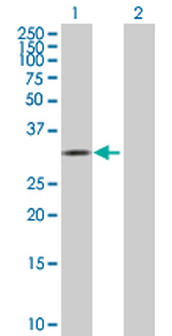 CDK10 Antibody in Western Blot (WB)
