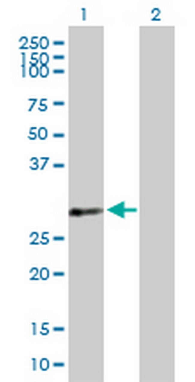 PDLIM4 Antibody in Western Blot (WB)