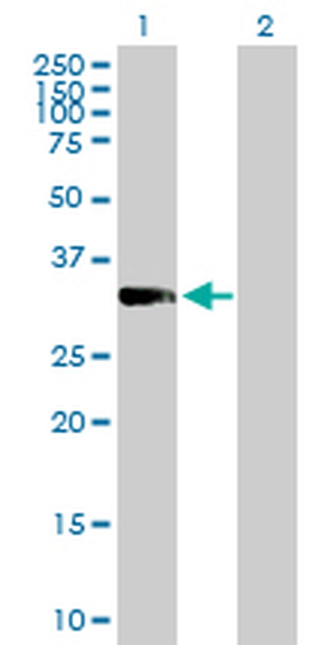 PRKRA Antibody in Western Blot (WB)