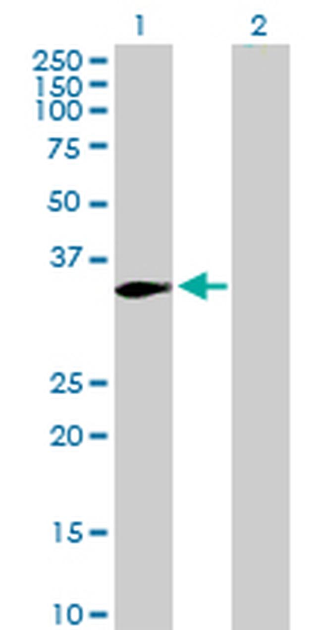 PRKRA Antibody in Western Blot (WB)