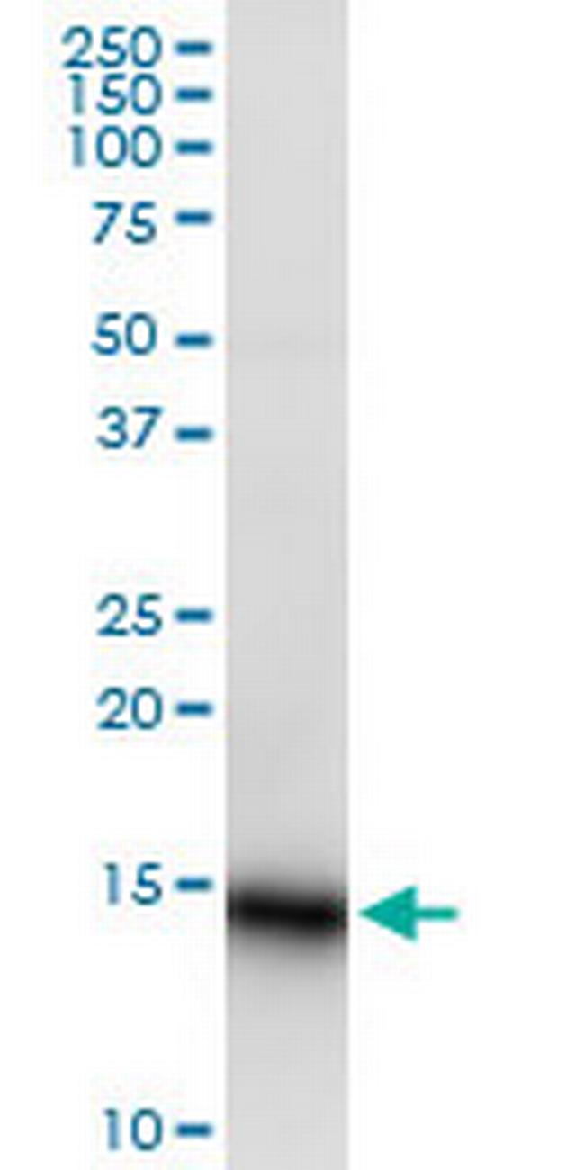 LY6D Antibody in Western Blot (WB)