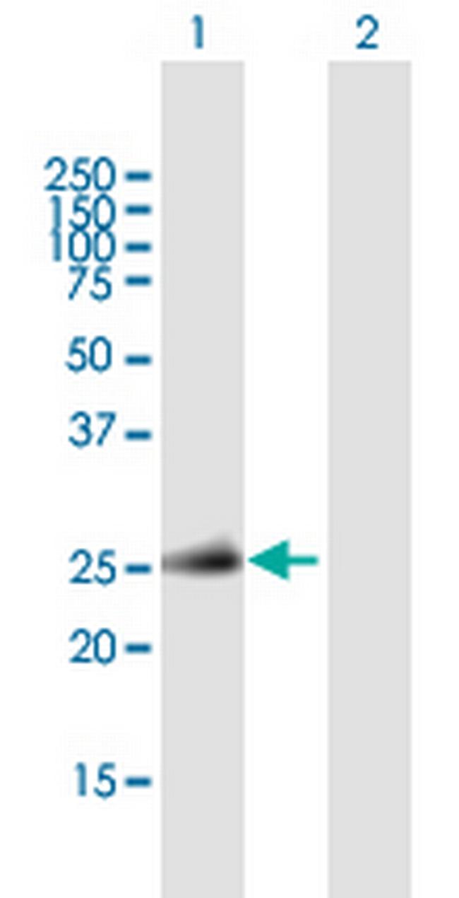 TNFSF11 Antibody in Western Blot (WB)
