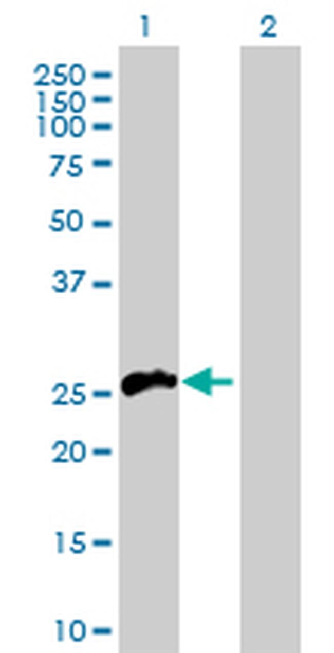 TNFSF11 Antibody in Western Blot (WB)