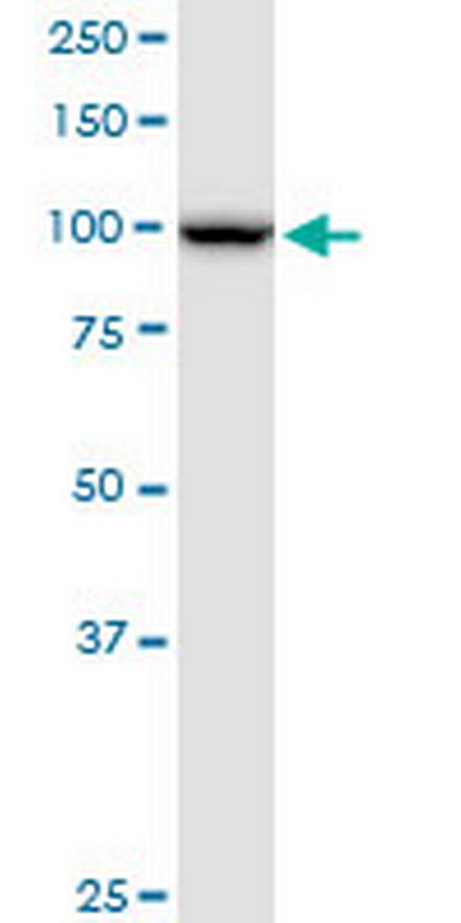 NOP14 Antibody in Western Blot (WB)