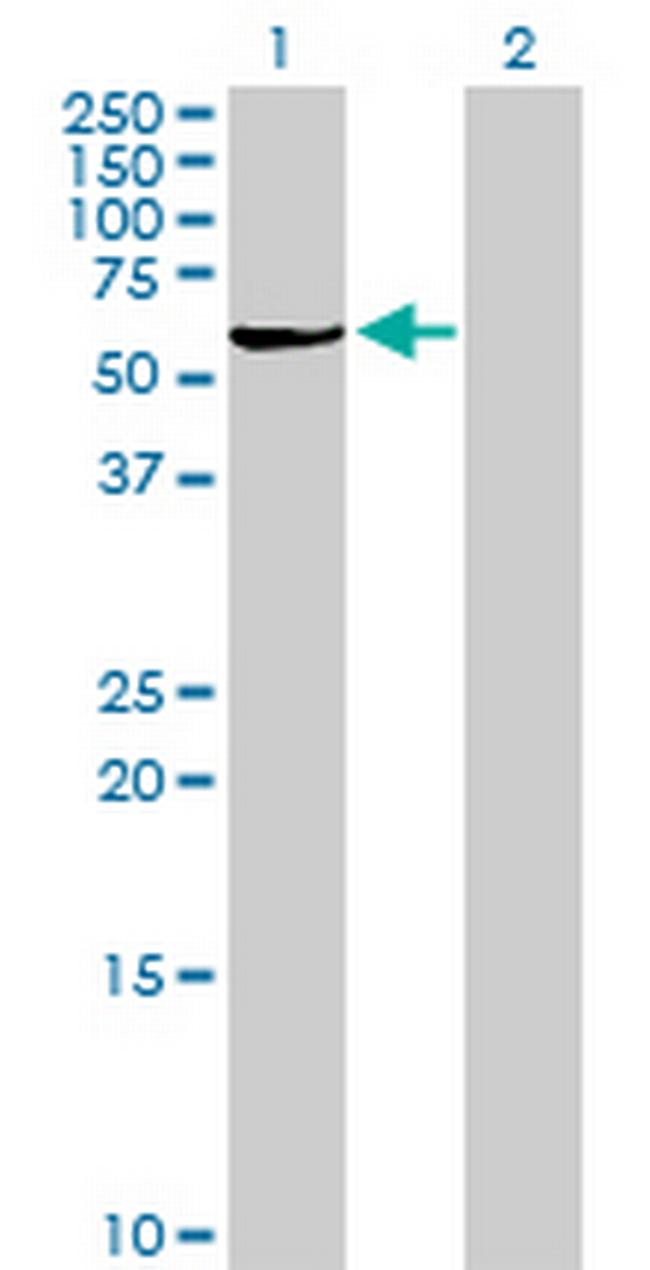 PLA2G4C Antibody in Western Blot (WB)