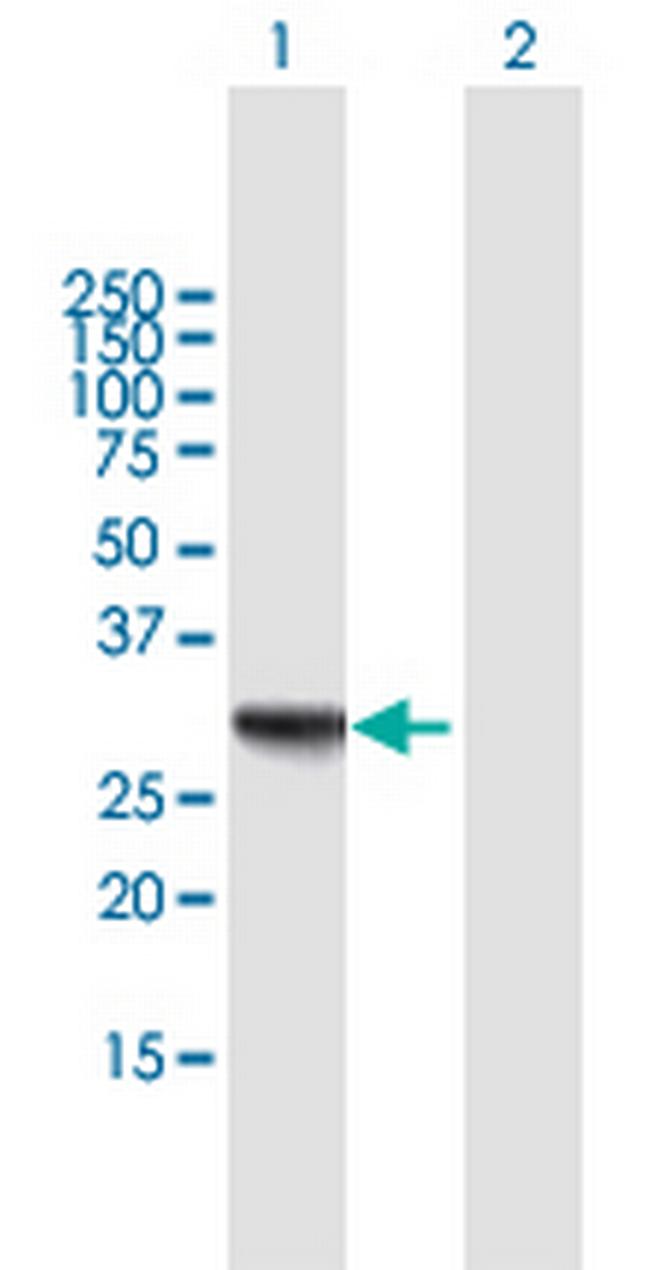 RDH16 Antibody in Western Blot (WB)