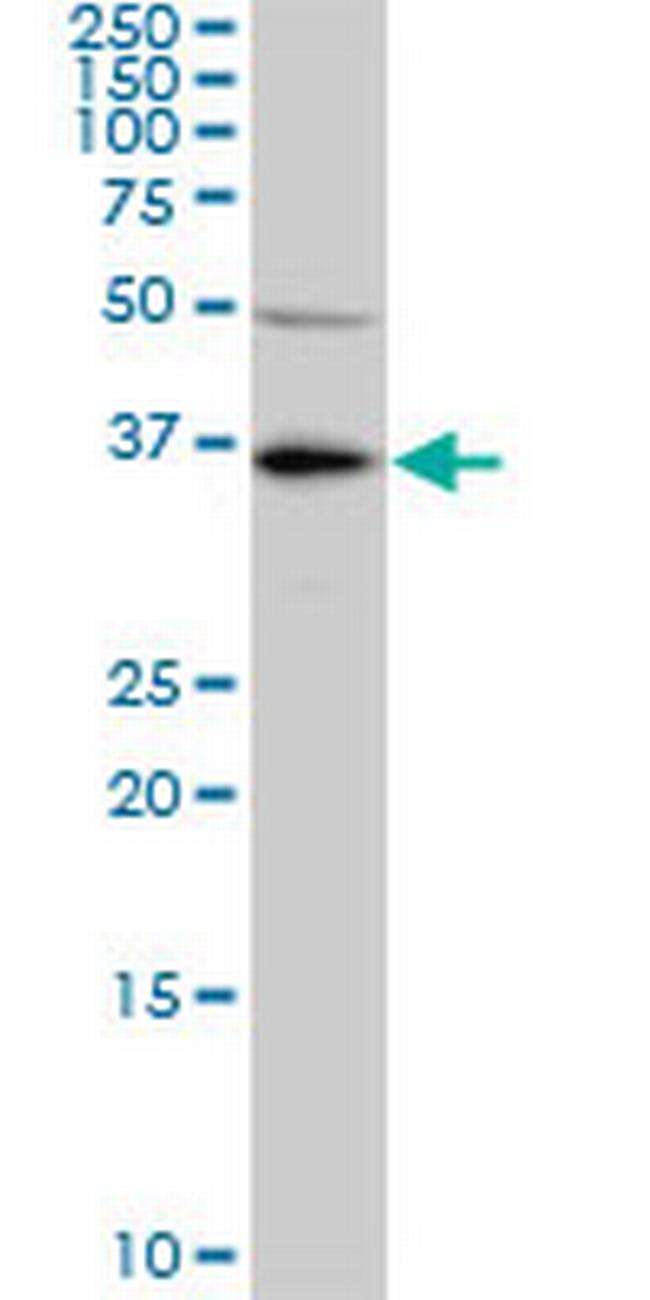 KLF7 Antibody in Western Blot (WB)