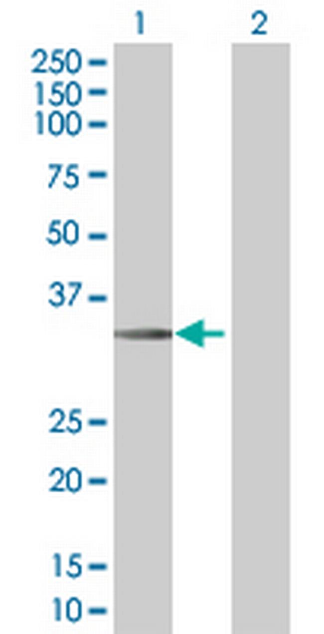 STC2 Antibody in Western Blot (WB)