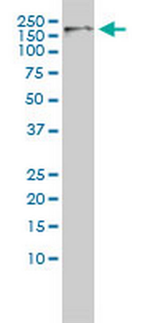 CDC2L5 Antibody in Western Blot (WB)