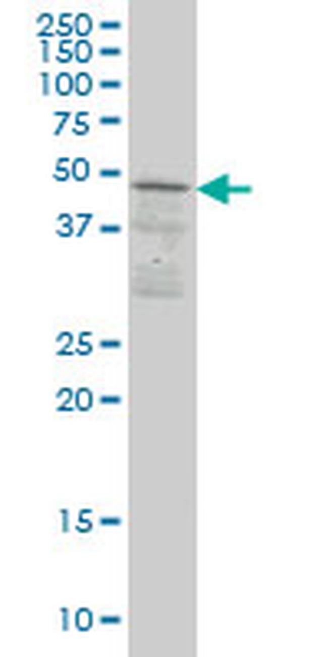 SCAP1 Antibody in Western Blot (WB)
