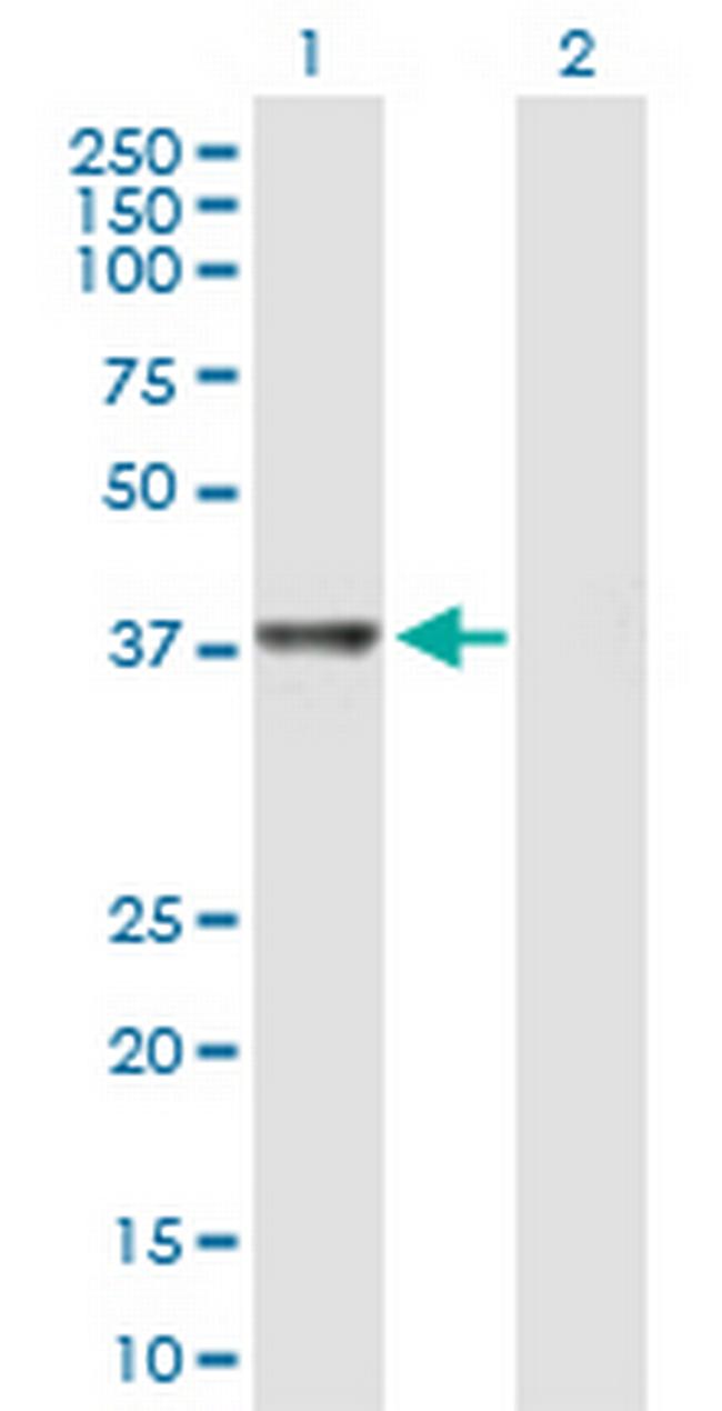 RTCD1 Antibody in Western Blot (WB)