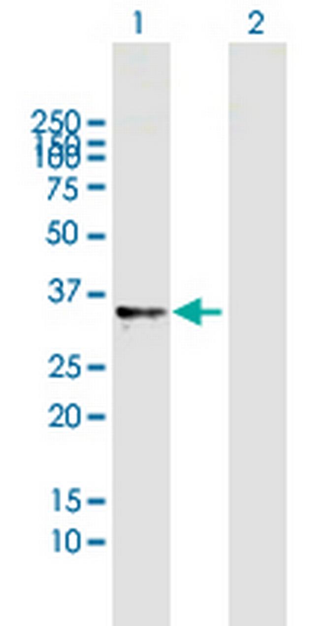 RNASET2 Antibody in Western Blot (WB)