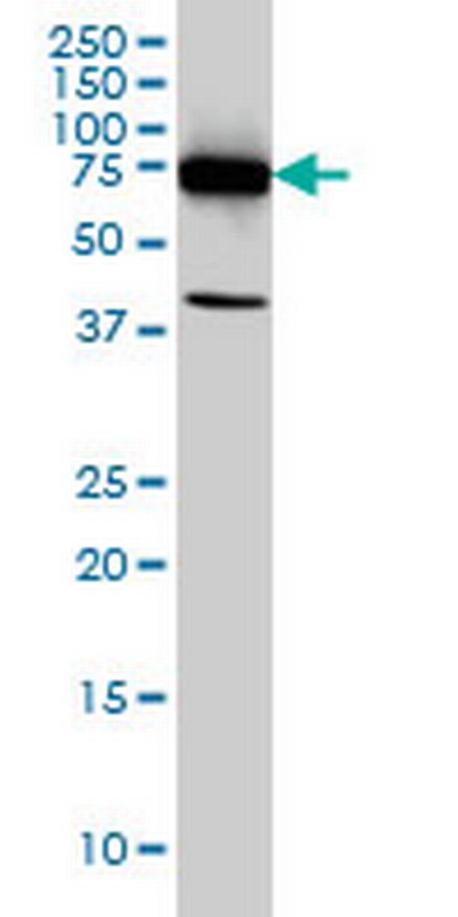 DDX3Y Antibody in Western Blot (WB)