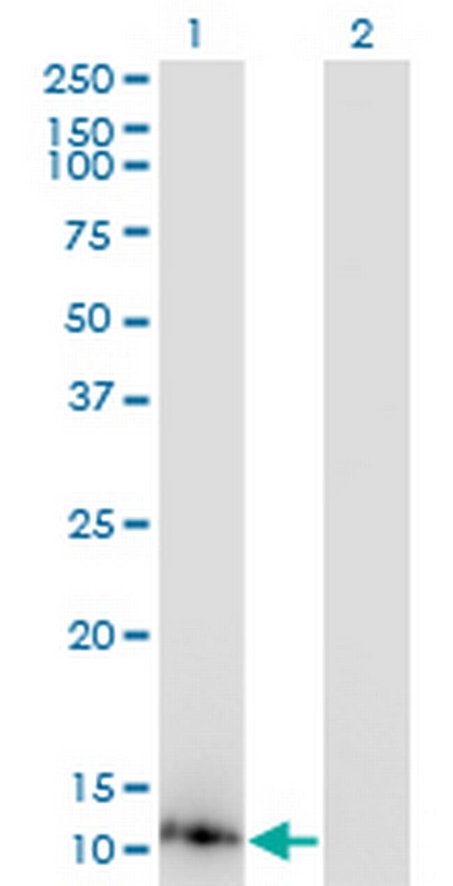DYNLL1 Antibody in Western Blot (WB)
