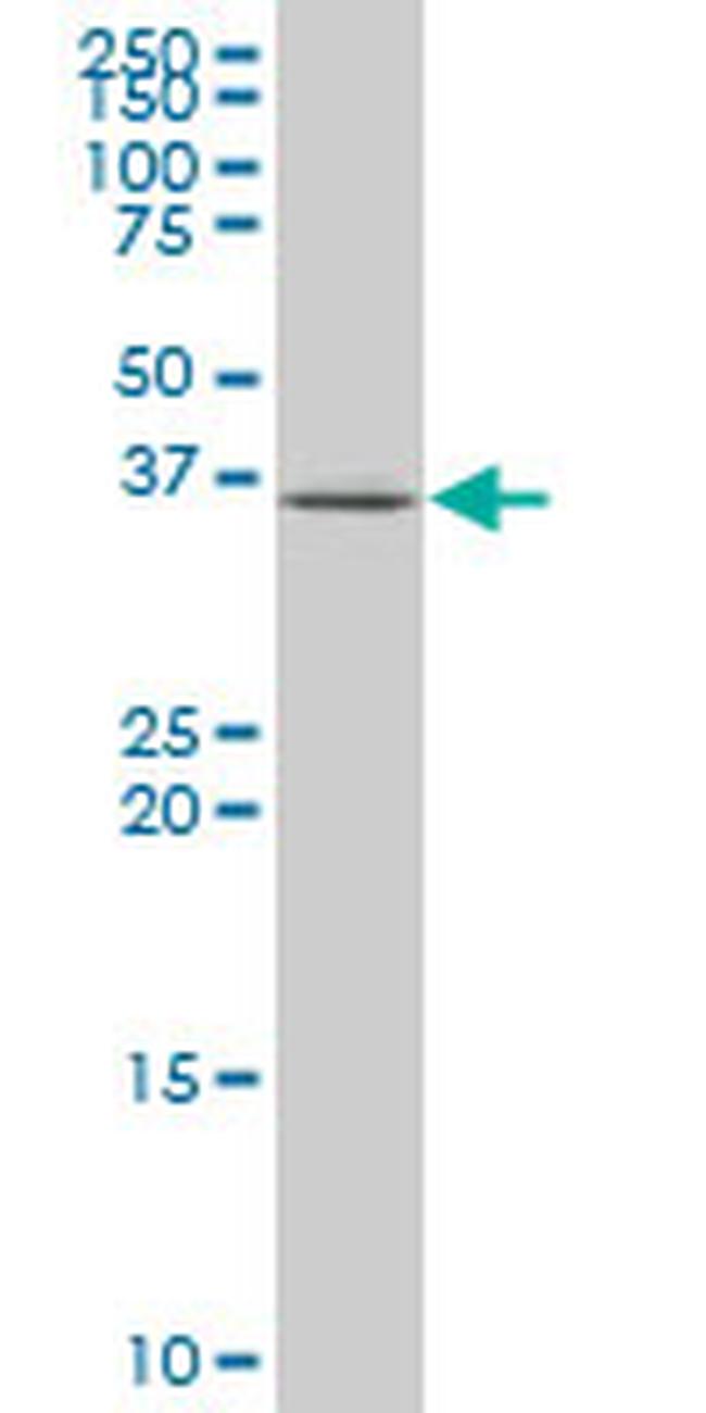 EIF3S3 Antibody in Western Blot (WB)