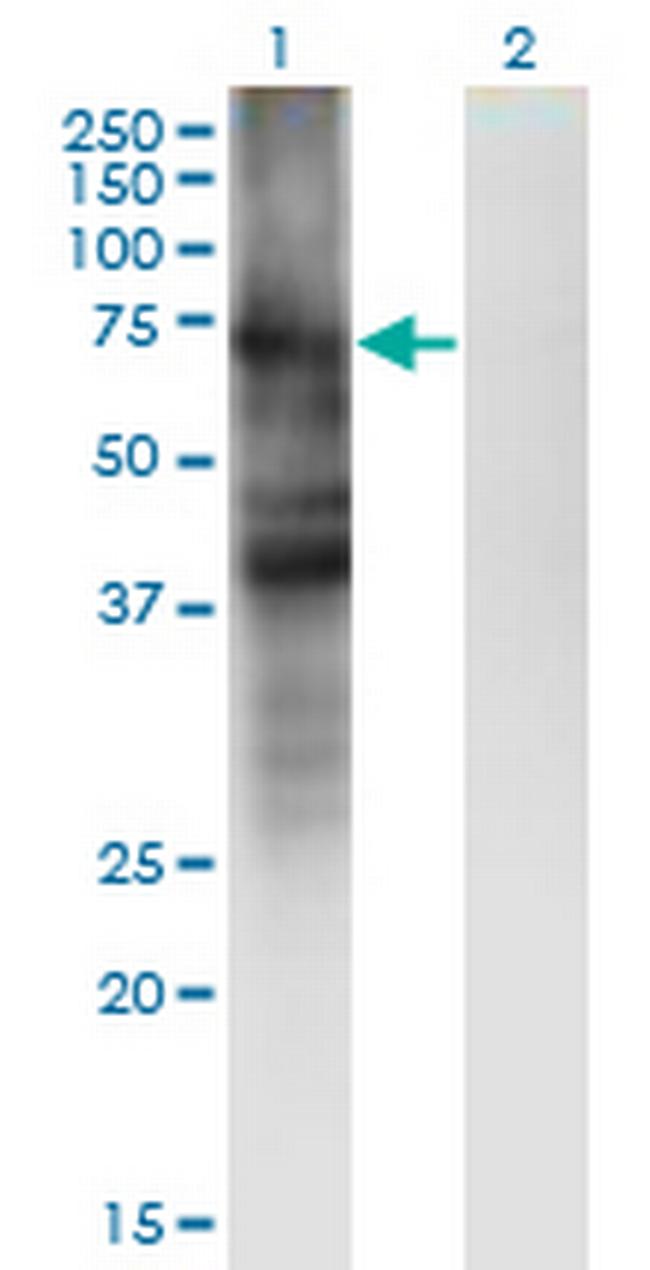 SLC4A4 Antibody in Western Blot (WB)