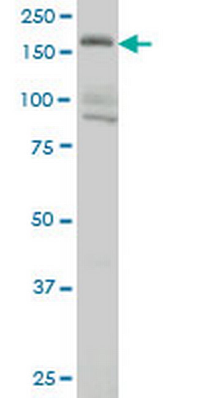 EIF4G3 Antibody in Western Blot (WB)